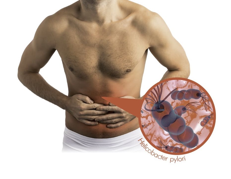 Мелкая, но опасная инфекция Helicobacter pylori