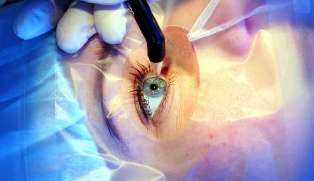 Естественная оптическая система. Идеальное зрение.