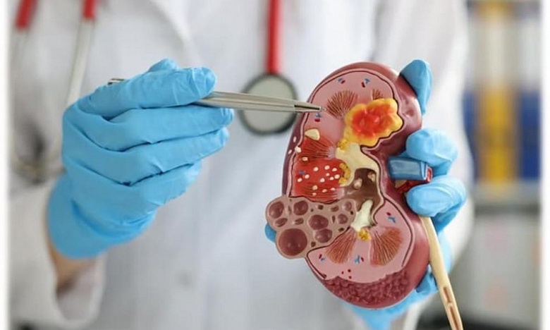 Почки – «живой» фильтр человеческого организма