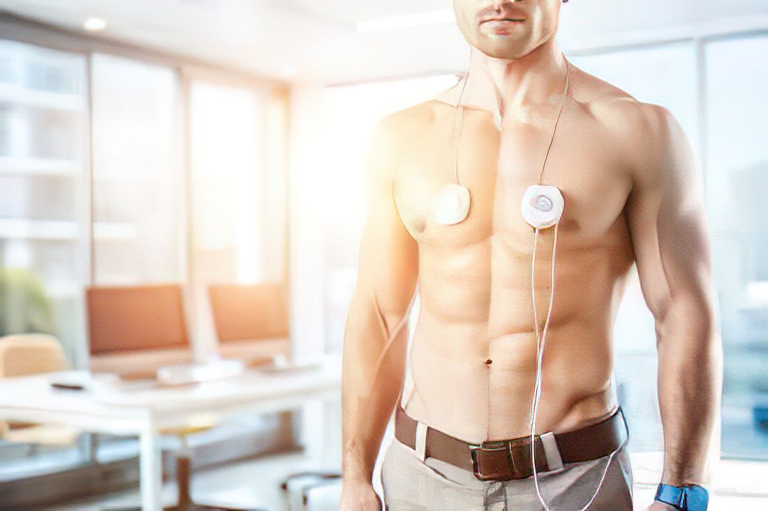 Суточный мониторинг ЭКГ