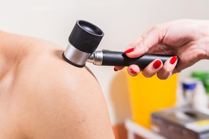 Дерматоскопія