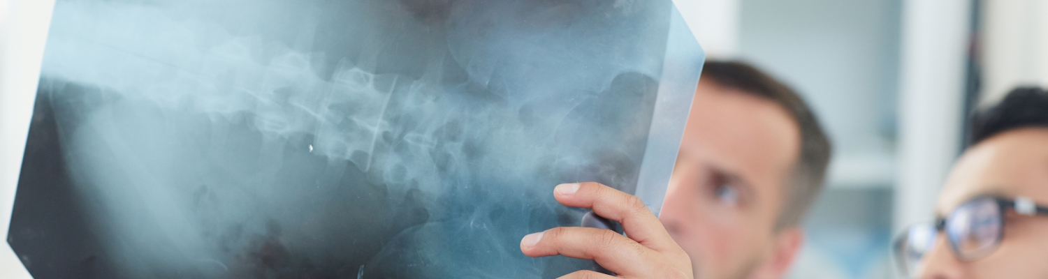 Рентгенография пояснично-крестцовых соединений