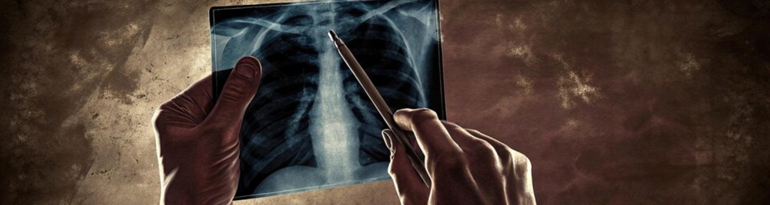 Панорамна рентгенографія хребта