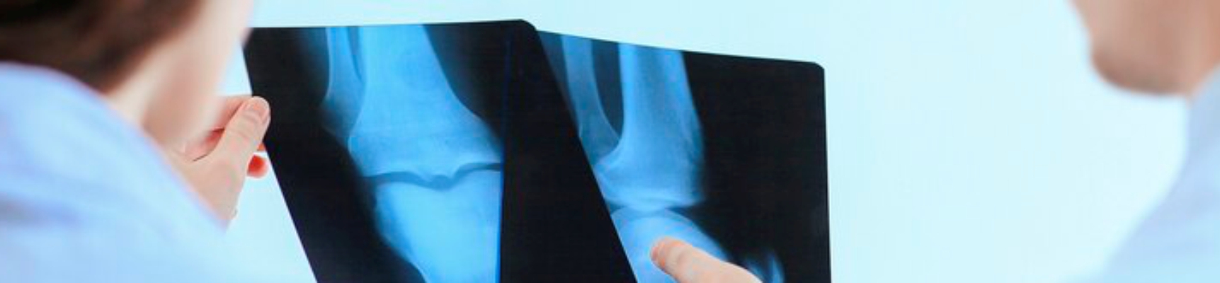 Рентгенография тазобедренных