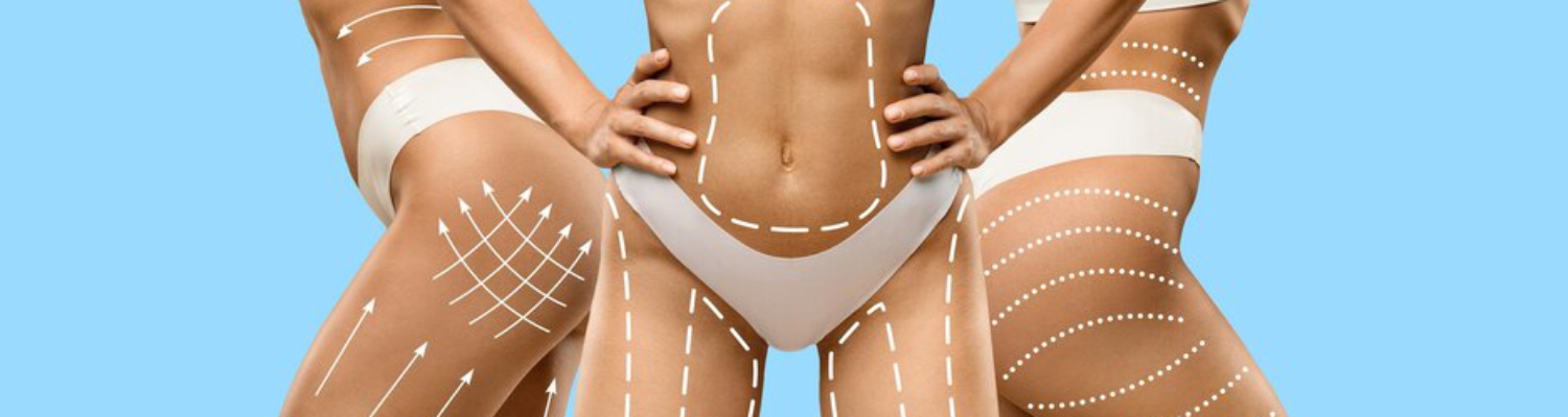 Ліпофілінг