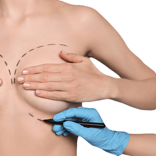 Пластика тест