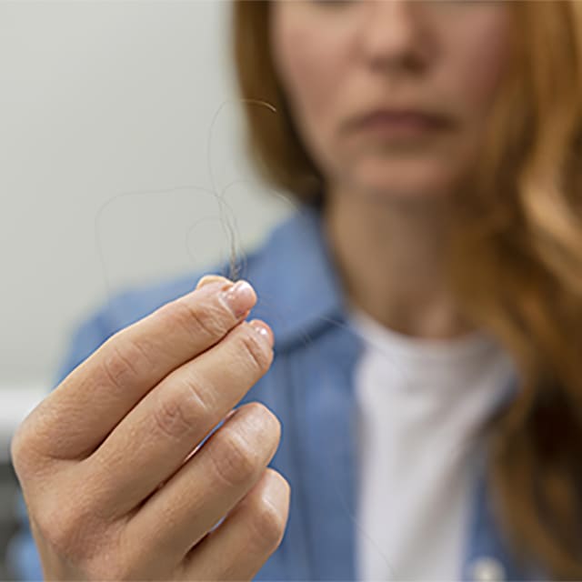 Чому випадає волосся: 10 головних причин алопеції у жінок і чоловіків