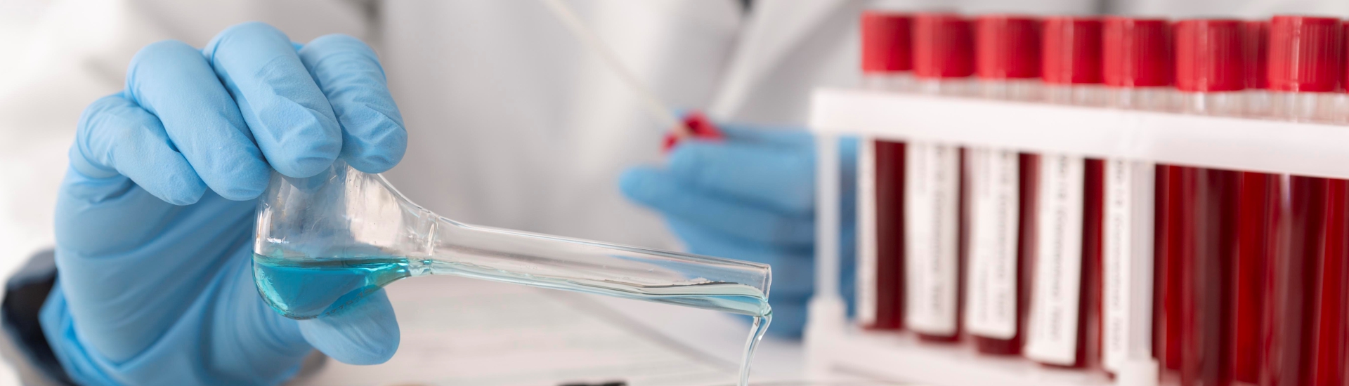 Як правильно читати загальний аналіз крові